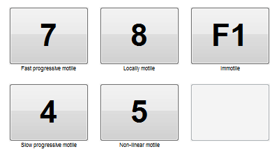 Mo11.png